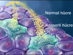 Kanserde bir umut ışığı belirdi